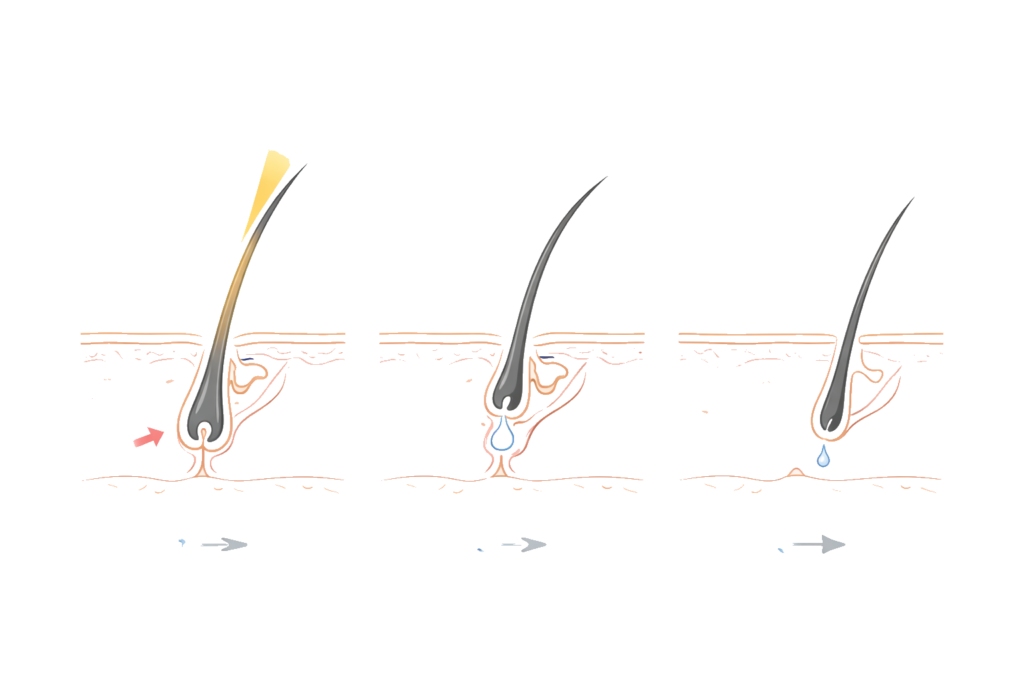 毛周期の3段階（成長期・退行期・休止期）と脱毛効果の関係図