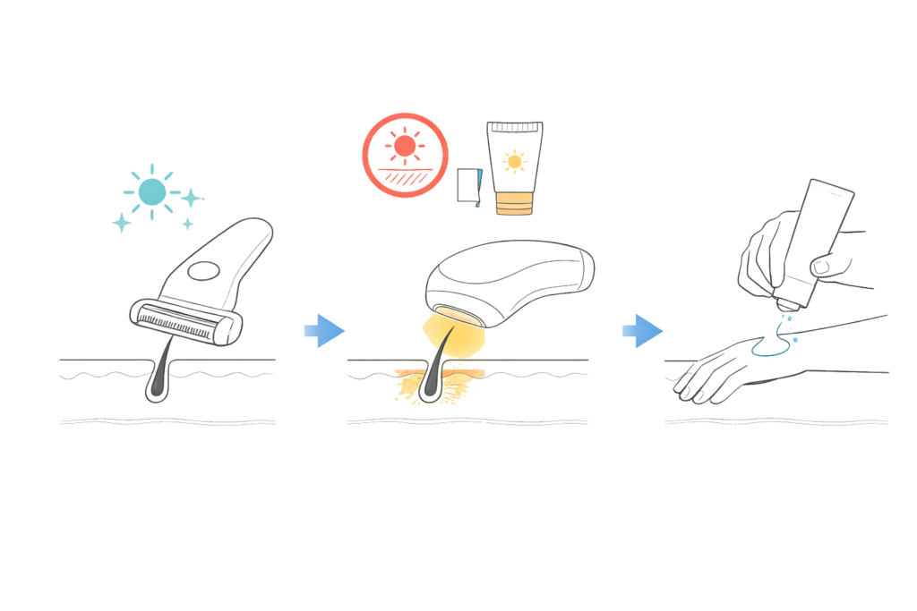 脱毛施術前後の流れと注意点(自己処理・照射・保湿ケア)