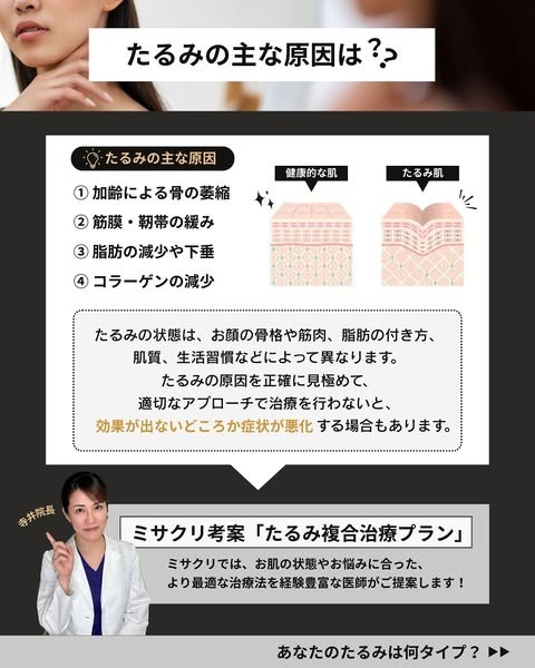 たるみの原因