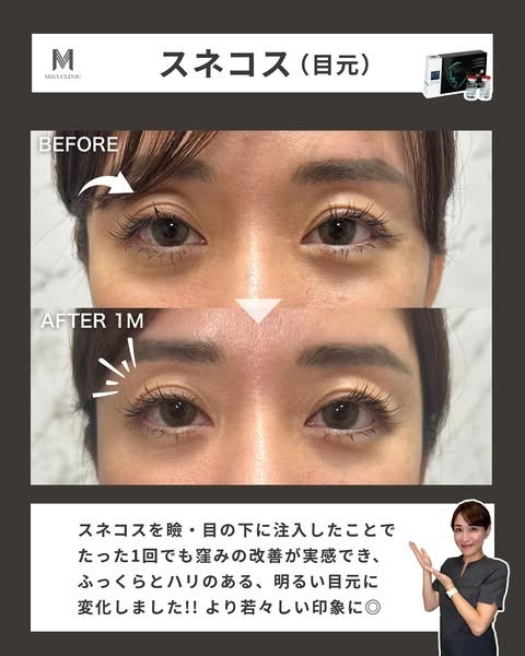 スネコスの効果