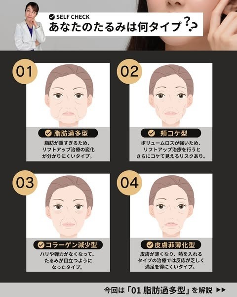 顔のたるみの原因4タイプ